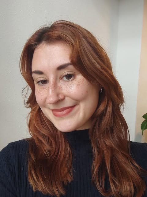 ✨ Healed Frecks ✨
Trust the Process 💫

Het genezen resultaat, 7 dagen na haar faux freckles behande