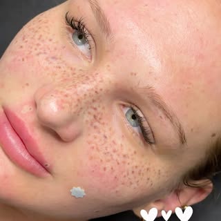 🌸 Faux Freckles 🌸
Layered to the max 🤍

▫️Techniek: Handpoke
▫️Signature (S/M) Pakket
▫️Beauty sp
