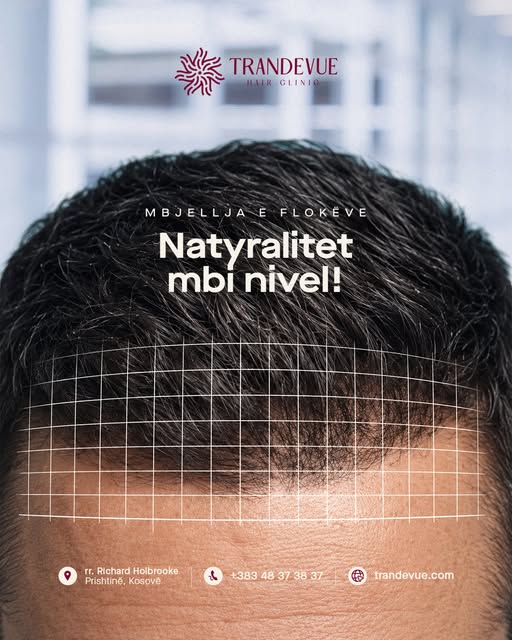 Me planifikim të kujdesshëm të vijës së flokëve dhe qasje të personalizuar për secilin pacient, syni