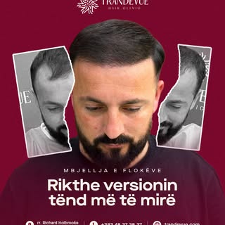 Versioni yt më i mirë po të pret, bëj hapin e parë në Trandevue tani dhe shiko ndryshimin. ✨

📍 Rez