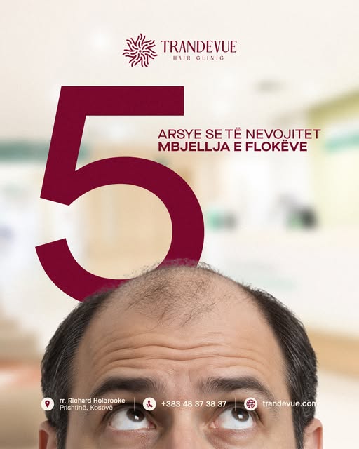 5 arsye që mund të tregojnë se të nevojitet mbjellja e flokëve:

– Vija e flokëve po tërhiqet gjithn