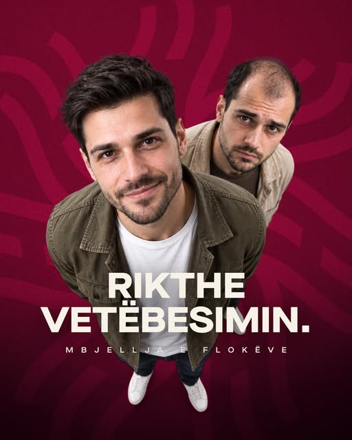 Rikthe vetëbesimin me një ndryshim që e ndjen çdo ditë.

Me mbjelljen e flokëve, synimi jonënuk ësht