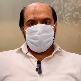 Enhance your Personality In only in 30Mins Mr Rizwan Sharing His experience of Non Surgical Hair Exp