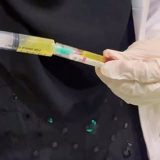 PRP ( Platlet Rich Plasma ) The Most Effective and Helpfull For Hair Thinning , Hairfalling and also