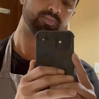 Mr Adnan ( Belgium ) I Gaining His Confidence Again After Hair Transplant from ADVNACED HAIR
CENTRE
