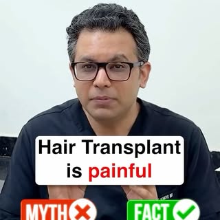 MYTH BUSTED: Are hair transplants painful?

Short answer: No.
Long answer 👇
Most people imagine ext