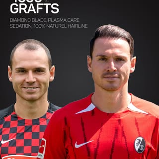 Before & After – Nicolas Höfler @chicco2727 
Professional performance on the pitch, professional res
