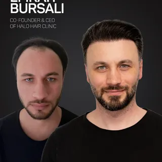 Ich weiß genau was es bedeutet keine Haare mehr zu haben.
Der Verlust von Selbstvertrauen. Die Unsic