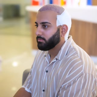 Frisch nach der Haartransplantation 
So sieht das Ergebnis direkt nach dem Eingriff aus.
Jedes Graft
