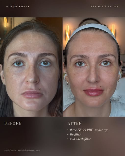 REFRESH. BRIGHTEN. REJUVENATE. 

Sometimes you don’t need a dramatic change—you just need a refresh.