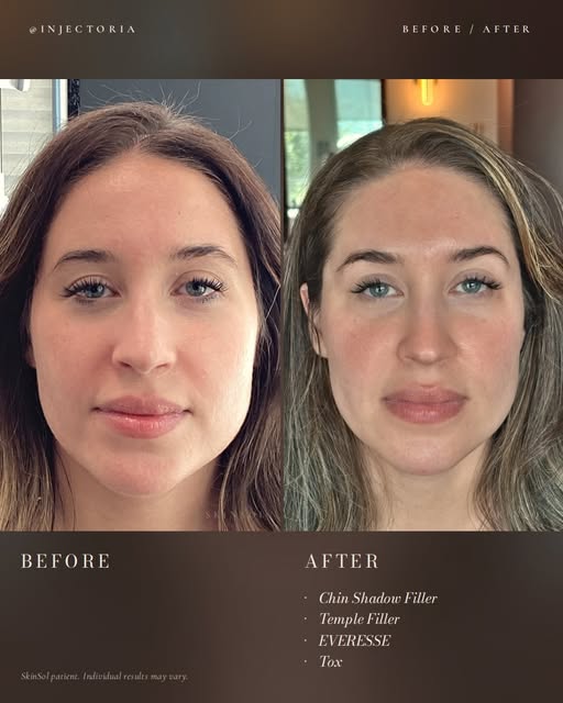 The best facial balancing doesn’t make you look different—it makes you look like the best version of