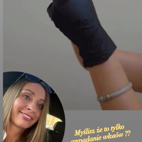 ❌ Myślisz, że to tylko wypadanie włosów? To może być sygnał problemów organizmu.
* Mieszkasz w Grudz