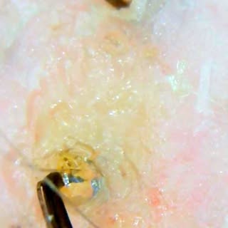 Let's discuss... the first photos show a scalp before cleansing, while the last two show the results