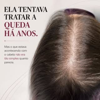 Ela tentava tratar a queda de cabelo há anos.

À primeira vista, poderia parecer apenas mais um caso