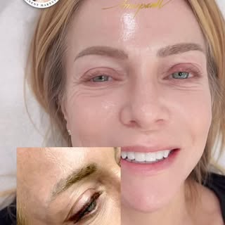 ✨ Brow Fix Alert! ✨
Came in with botched brows from another salon? Don’t worry — I’ve got you. 💪💉
