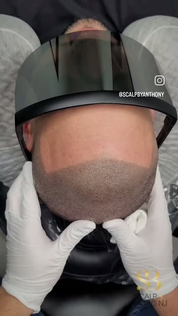 Every hairline is custom-designed 🎯
Based on your age, facial features, profession, personal style,