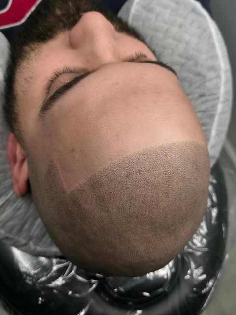 This is how a Sharp, Straight hairline should look. We can do it sharp, but still completely natural