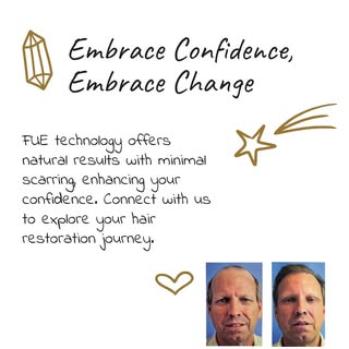 What are the benefits of FUE technology? 🌟 

FUE offers natural-looking results and minimal scarrin