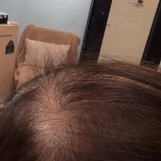 The amount of new growth my client is experiencing is AMAZING! 

Every single part I take on her hea
