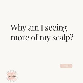 If you are seeing more of your scalp and you are noticing a change, then we need to figure out why.
