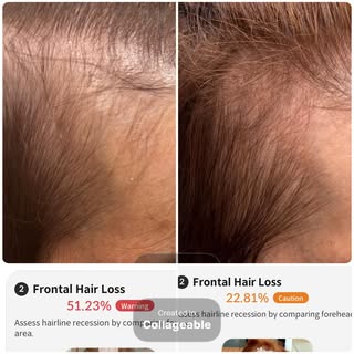 Progress you can see 🌱

This client’s journey has layers most people don’t see in a before-and-afte