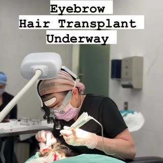 👀Eyebrow Transplant?!?
Yes 🙌 
Did you know we can transplant hairs from the back of your head to y