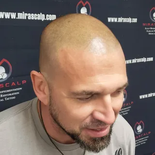 The Smile Says It All.😁 Allow us to help you if you are going bald or thinning out. 💪Get your hair