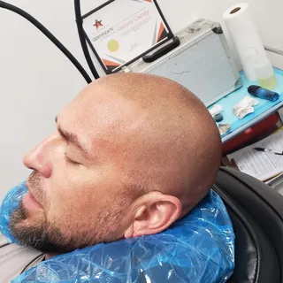Each customer is unique & different. We specialize in creating a natural 5 o clock shadow soft hairl