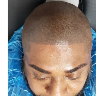 We specialize in creating a natural 5 o clock shadow soft hairline for customers struggling with bal