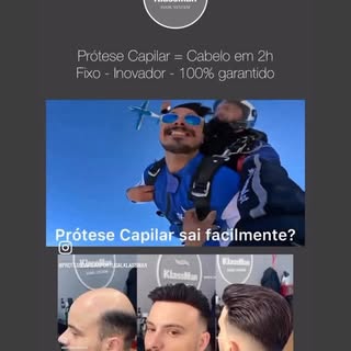 Prótese Capilar é um sistema inovador em que possibilita a colocação de cabelo em apenas 2h! 
Sem do