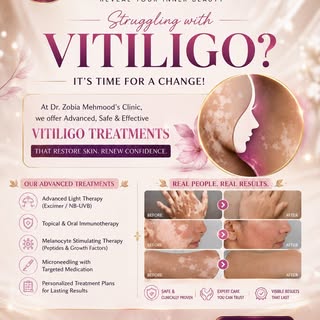 #vitiligo #vitiligoawareness