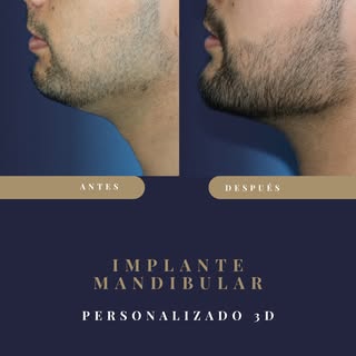 Cuando hablamos del perfil, solemos pensar en la piel o en el volumen. Pero muchas veces lo que falt