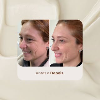 Um antes e depois que mostra muito mais do que uma mudança estética. ✨

Cada detalhe do rosto tem su