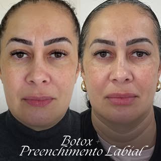 Um resultado que une dois cuidados diferentes, mas com o mesmo objetivo: valorizar a beleza de forma