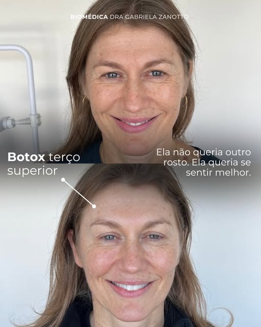 Às vezes, uma pequena mudança já faz diferença na forma como você se enxerga. 🤍

Uma pele mais firm