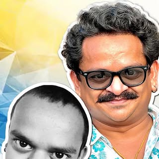 🎥 Watch Famous Actor Ankur Wadhave’s 8-Month Post-Hair Transplant Journey! 🌟

After undergoing a h