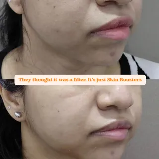 Stop wasting money on expensive serums that just sit on top of your skin. 🛑

​If you’re trying to c