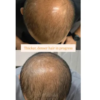​"Is it actually going to work?" — The most common question we get about hair thinning.

​Here is yo
