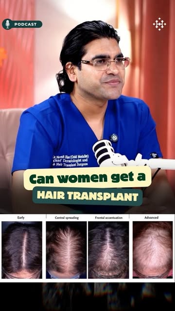 Can women get a hair transplant? 👀

Hair transplant can be an option for selected women experiencin