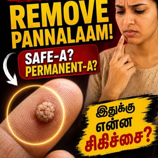 Warts remove பண்ணலாமா? Safe-ஆ? மீண்டும் வருமா? 👀

Hand-ல் small wart ஆரம்பிச்சு, சில நேரங்களில் அது