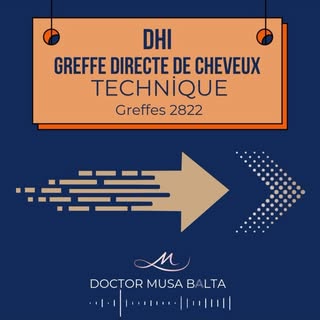 La greffe de cheveux peut être réalisée sans couper vos cheveux.
.
.
.
.
.
.
.
 #greffedecheveux #gr