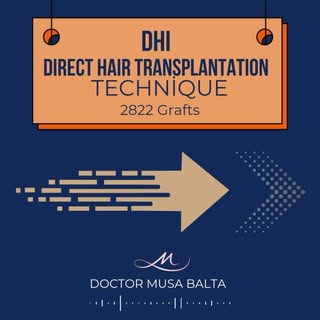 Hair transplantation can be done without cutting your hair.
.
.
.
.
.
.
.
#hairtransplantturkey #hai