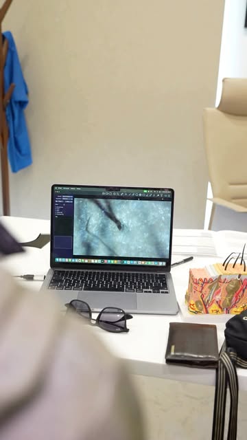 Details matter.
I dettagli contano.
Les détails comptent.

#hairtransplantturkey #hairtransplantista