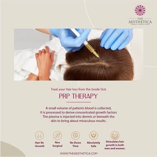 PRP (platelet-rich plasma) therapy for hair loss is a three-step medical treatment in which a person