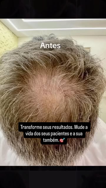Às vezes, 3 sessões são suficientes para começar a devolver algo que vai muito além dos fios: a espe