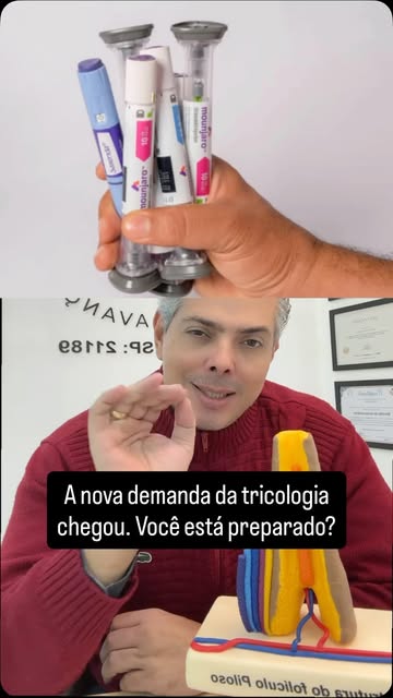 As canetas emagrecedoras estão criando uma nova demanda para a Reabilitação Capilar.

Medicamentos q
