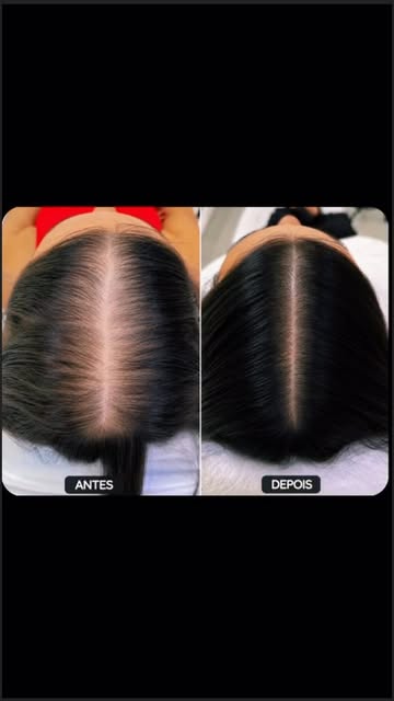 OLHA ESSE ANTES E DEPOIS. E ME DIZ SE ISSO NÃO CHAMA ATENÇÃO.

Não é mágica.
Não é sorte.
É estratég