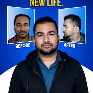 New Hair. New Life.

Meet Dr. Vaibhav Shah — one of Mumbai's most trusted hair transplant specialist
