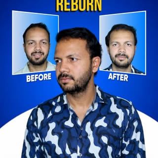 Hairline Reborn

Meet Dr. Vaibhav Shah — one of Mumbai's most trusted hair transplant specialists, d