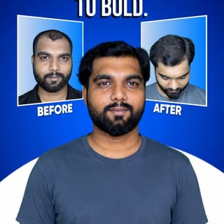From Bald to Bold

Meet Dr. Vaibhav Shah — one of Mumbai's most trusted hair transplant specialists,